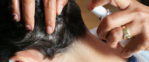 Препараты от педикулеза 3